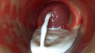 Camera Median Deep Pussy Captures Huge Ejaculation of Sperm ASMR